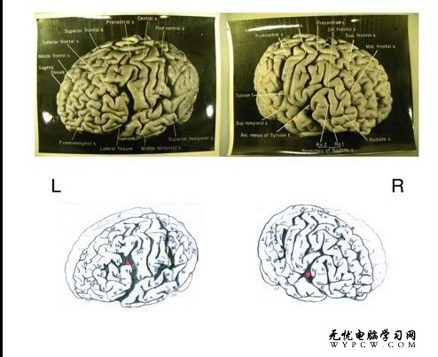 愛因斯坦的大腦一直以來是科學家們感興趣的研究對象，近期研究發現這位大物理學家的大腦在很多方面的確與眾不同