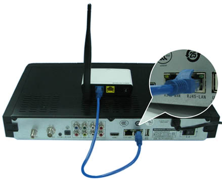 【教程】網絡機頂盒如何設置網絡連接