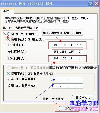 本地IP地址設置