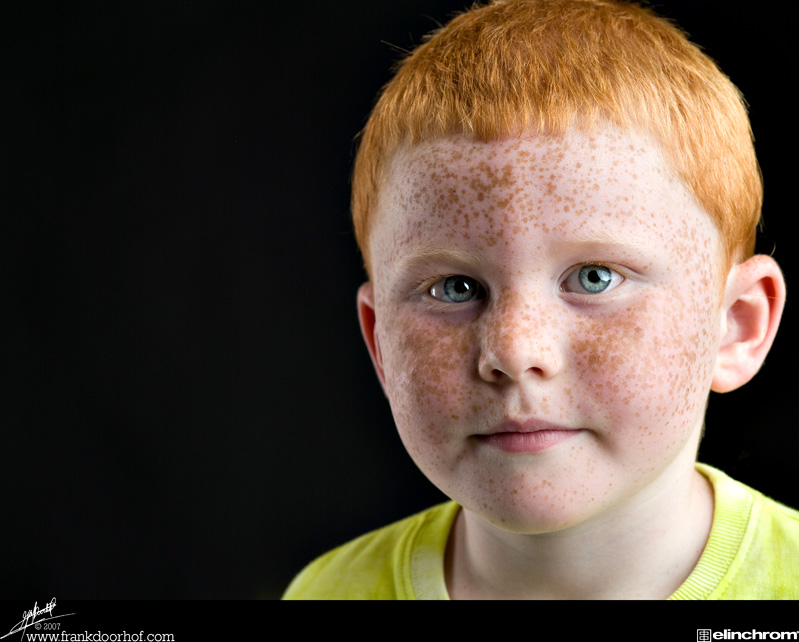 PhotoShop給滿臉雀斑的小男孩磨皮教程 三聯
