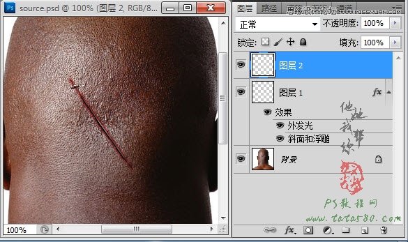 Photoshop合成人物縫合的傷口效果教程,PS教程,素材中國