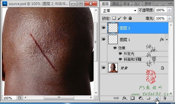 Photoshop合成人物縫合的傷口效果教程,PS教程,素材中國