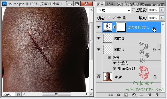 Photoshop合成人物縫合的傷口效果教程,PS教程,素材中國