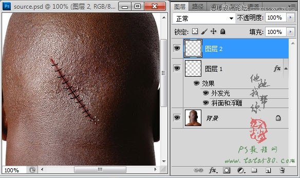 Photoshop合成人物縫合的傷口效果教程,PS教程,素材中國